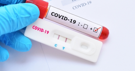 Cinco novos casos de COVID-19 nesta quarta-feira (29)